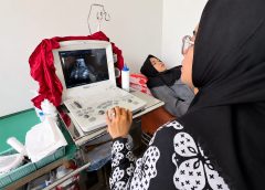 GERBANG PEMIRSA, Inovasi Puskesmas Segala Mider Wujudkan Persalinan Aman Sejak Masa Kehamilan